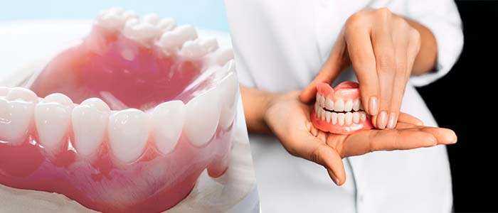 tipos y beneficios protesis dentales