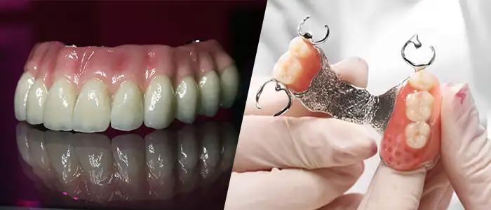 protesis removibles dentales